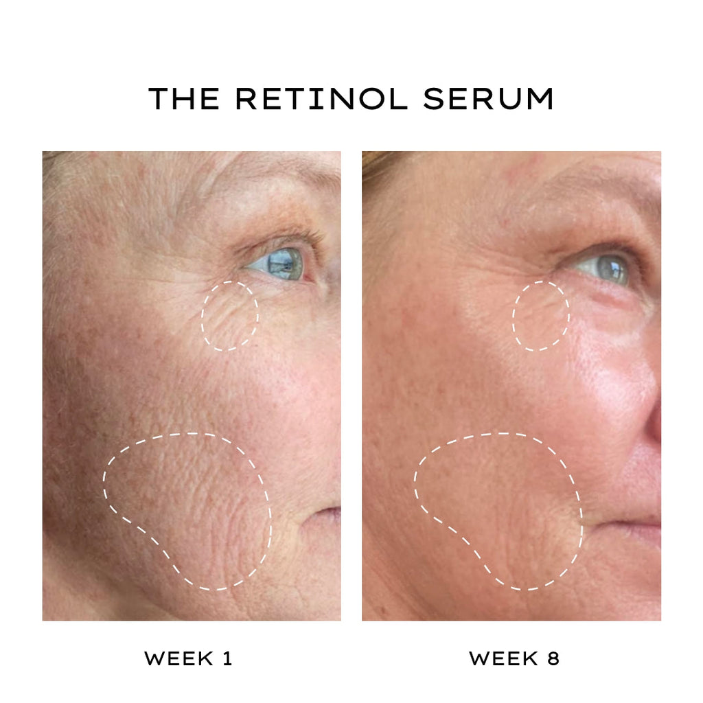 The Retinol Serum